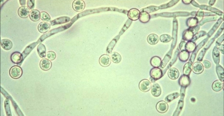 INFECTIONS CAUSED BY CANDIDA ALBICANS. MYTH OR REALITY?